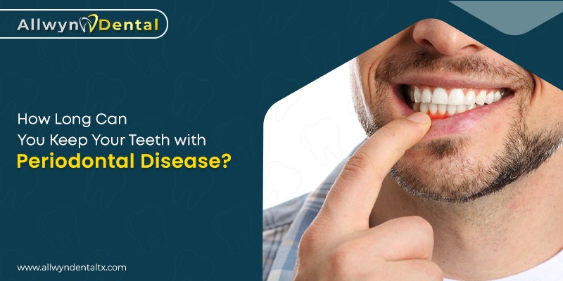 teeth with periodontal disease