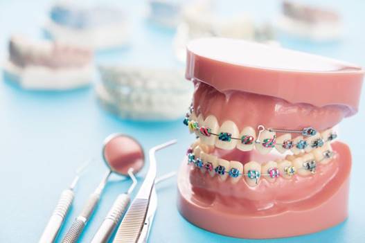 Orthodontic Treatment